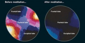 mri scan hersenen na meditatie